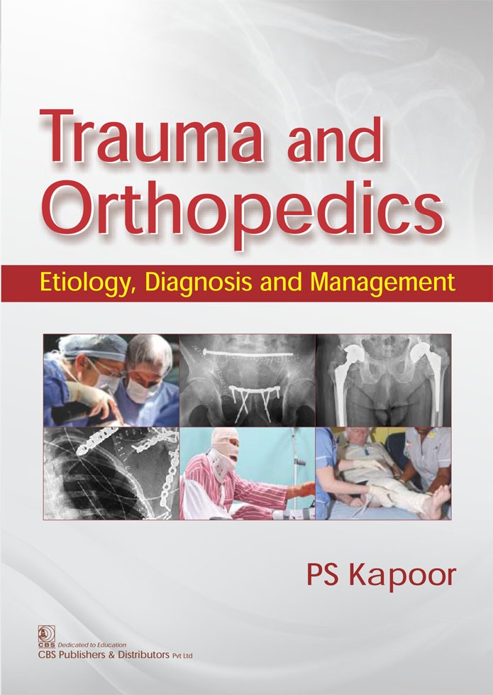 Trauma and orthopedics: etiology, diagnosis and management