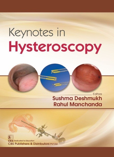 Keynotes in hysteroscopy