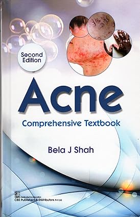Acne comprehensive textbook