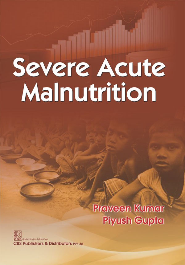 Severe acute malnutrition