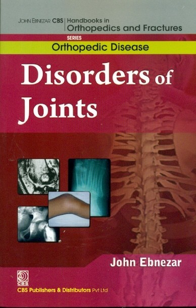 Disorders of joints (handbooks in orthopedics and fractures series, vol. 32: orthopedic disease)