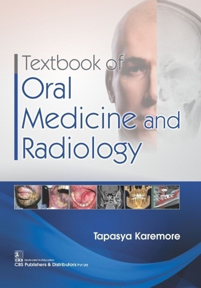 Textbook of oral medicine and radiology