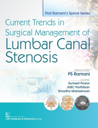 Prof ramani’s spinal series: current trends in surgical management of lumbar canal stenosis