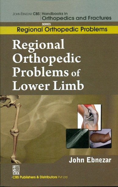 Regional orthopedic problems of lower limb (handbooks in orthopedics and fractures series, vol. 49: regional orthopedic problems)