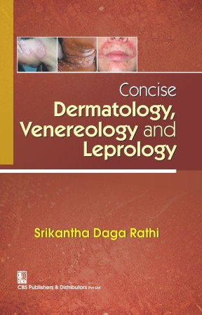 Concise dermatology venereology and leprology