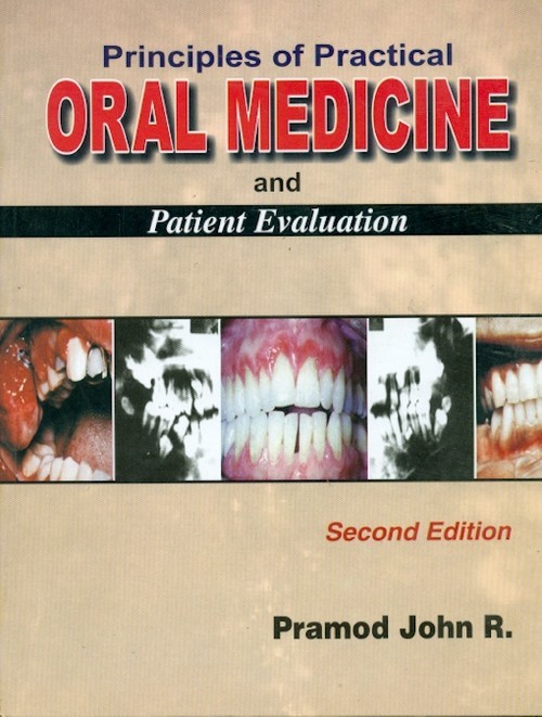 Principles of practice oral medicine and patient evaluation, 2e