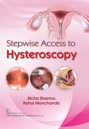 Stepwise access to hysteroscopy