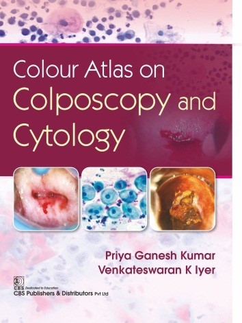 Colour atlas on colposcopy and cytology