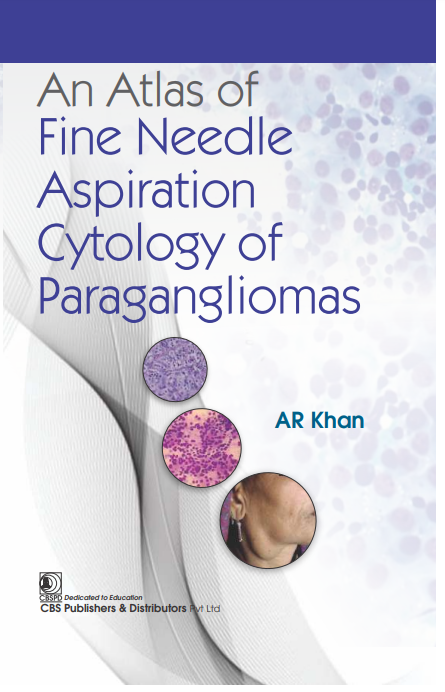 An atlas of fine needle aspiration cytology of paragangliomas