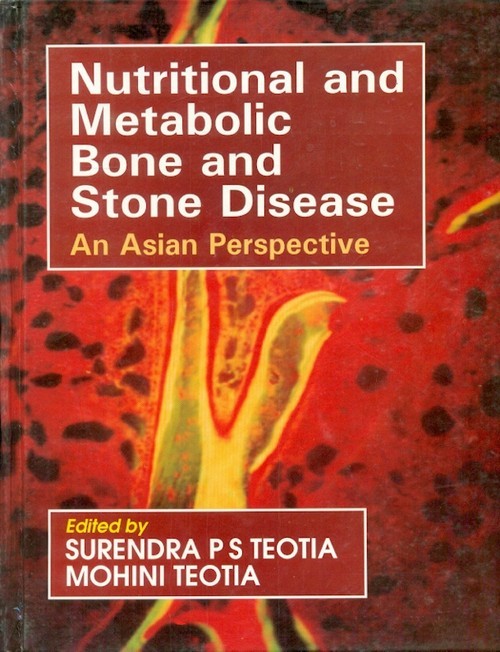 Nutritional and metabolic bone and stone disease: an asian perspective