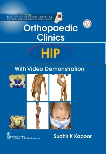 Orthopedic clinics: hip with video demonstration