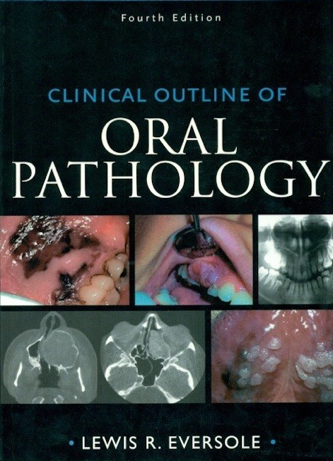 Clinical outline of oral pathology 4ed (pb)