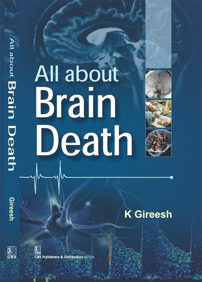 All about brain death 