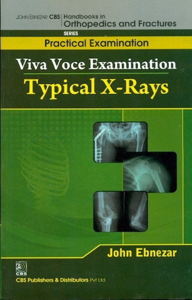 Typical x-rays (handbooks in orthopedics and fractures series, vol. 65-practical examination)