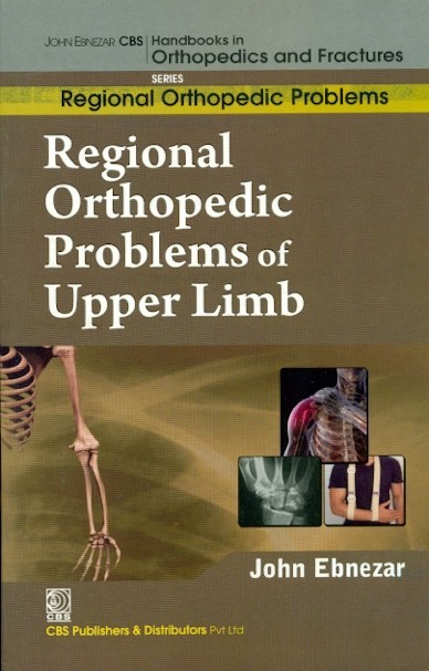 Regional orthopedic problems of upper limb (handbooks in orthopedics and fractures series, vol.48: regional orthopedic problems)