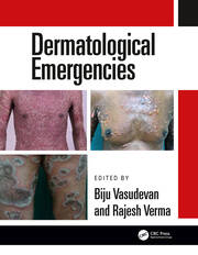 Dermatological emergencies (pb 2019)