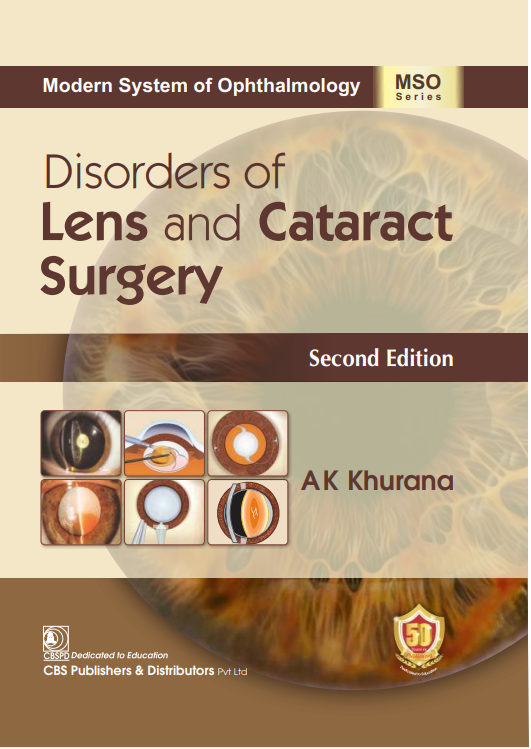 Modern system of ophthalmology (mso series):disorders of lens and cataract surgery
