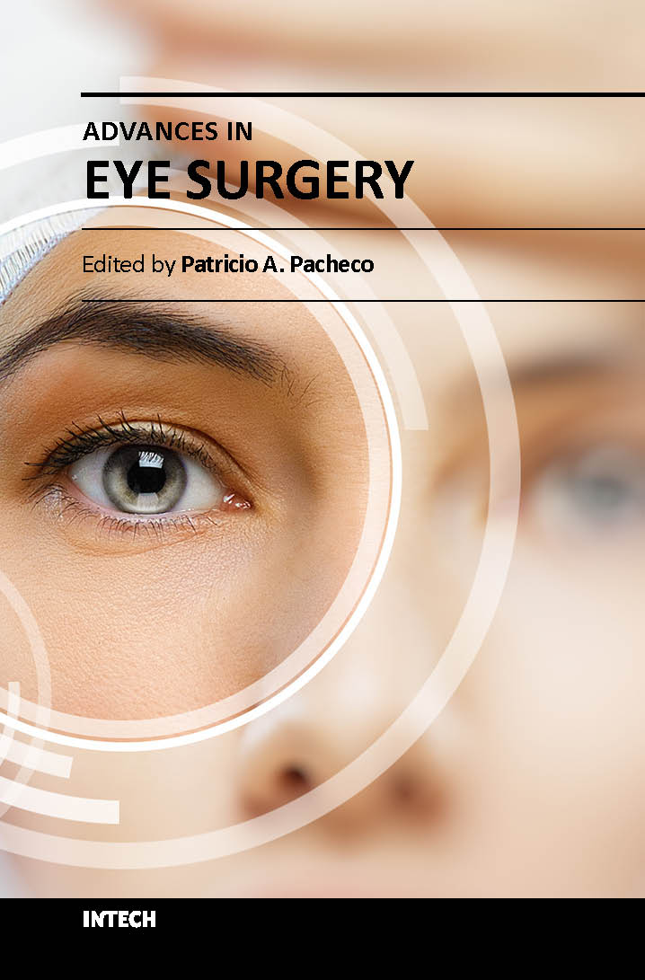 Advances in eye surgery (hb 2017)