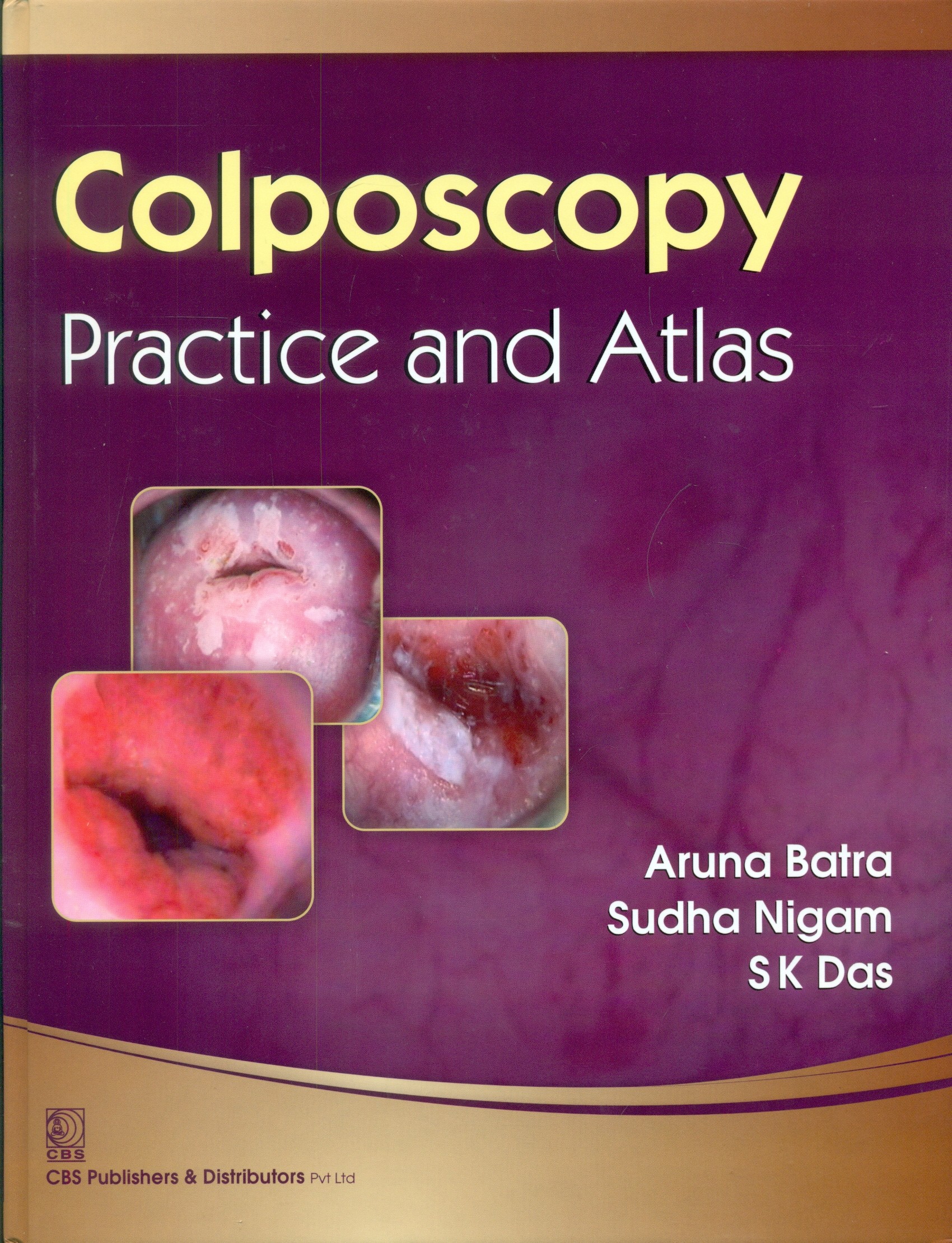 Colposcopy practice and atlas (hb-2014)