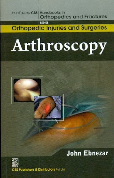 Arthroscopy (handbooks in orthopedics and fractures series, vol. 61- orthopedic injuries and surgeries)
