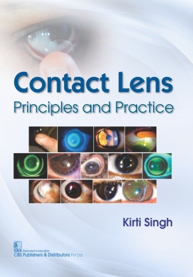 Contact lens principles and practice