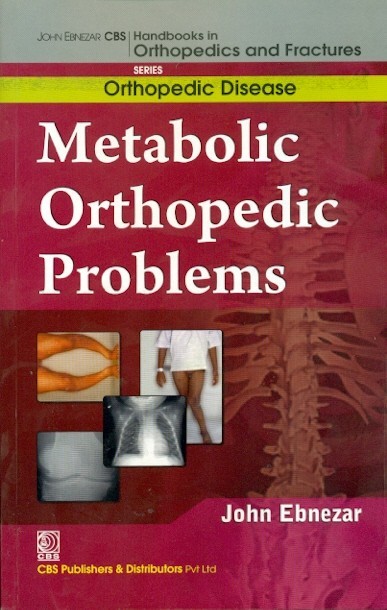 Metabolic orthopedic problems (handbooks in orthopedics and fractures series, vol.30: orthopedic disease))