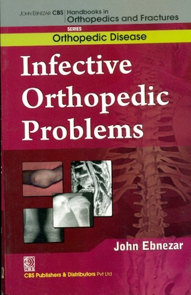 Infective orthopedic problems developmental orthopedic problems (handbooks in orthopedics and fractures series, vol. 31: orthopedic disease)