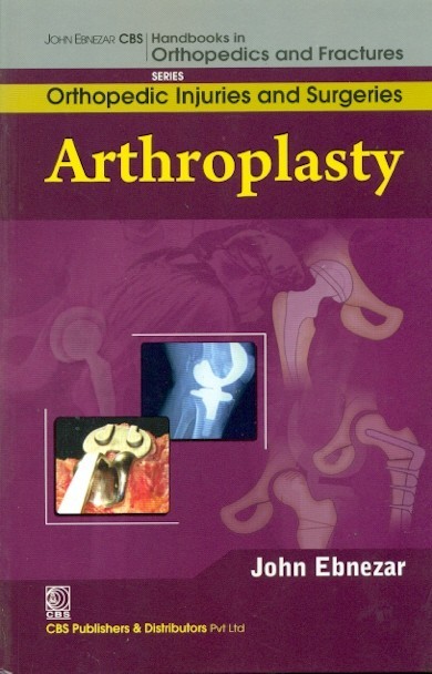 Arthroplasty (handbooks in orthopedics and fractures series, vol. 62 -orthopedic injuries and surgeries)