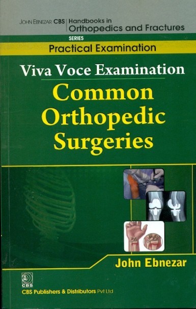 Viva voce examination common orthopedic surgeries (handbooks in orthopedics and fractures series, vol. 69-practical examination)