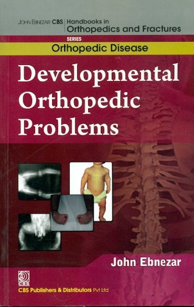 Developmental orthopedic problems (handbooks in orthopedics and fractures series, vol. 29: orthopedic disease)