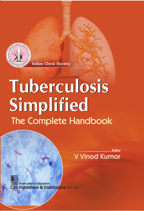 Tuberculosis simplified the complete handbook