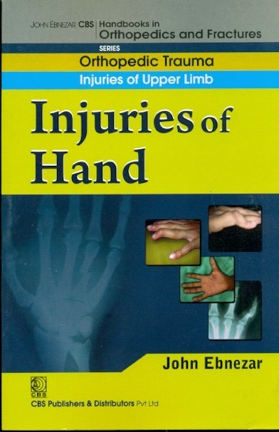 Injuries of hand (handbooks in orthopedics and fractures series, vol. 11: orthopedic trauma injuries of upper limb)