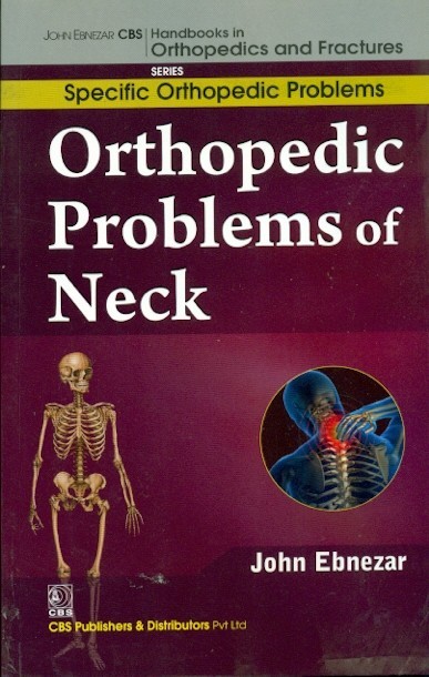 Orthopedic problems of neck (handbooks in orthopedics and fractures series, vol.39: specific orthopedic problems)