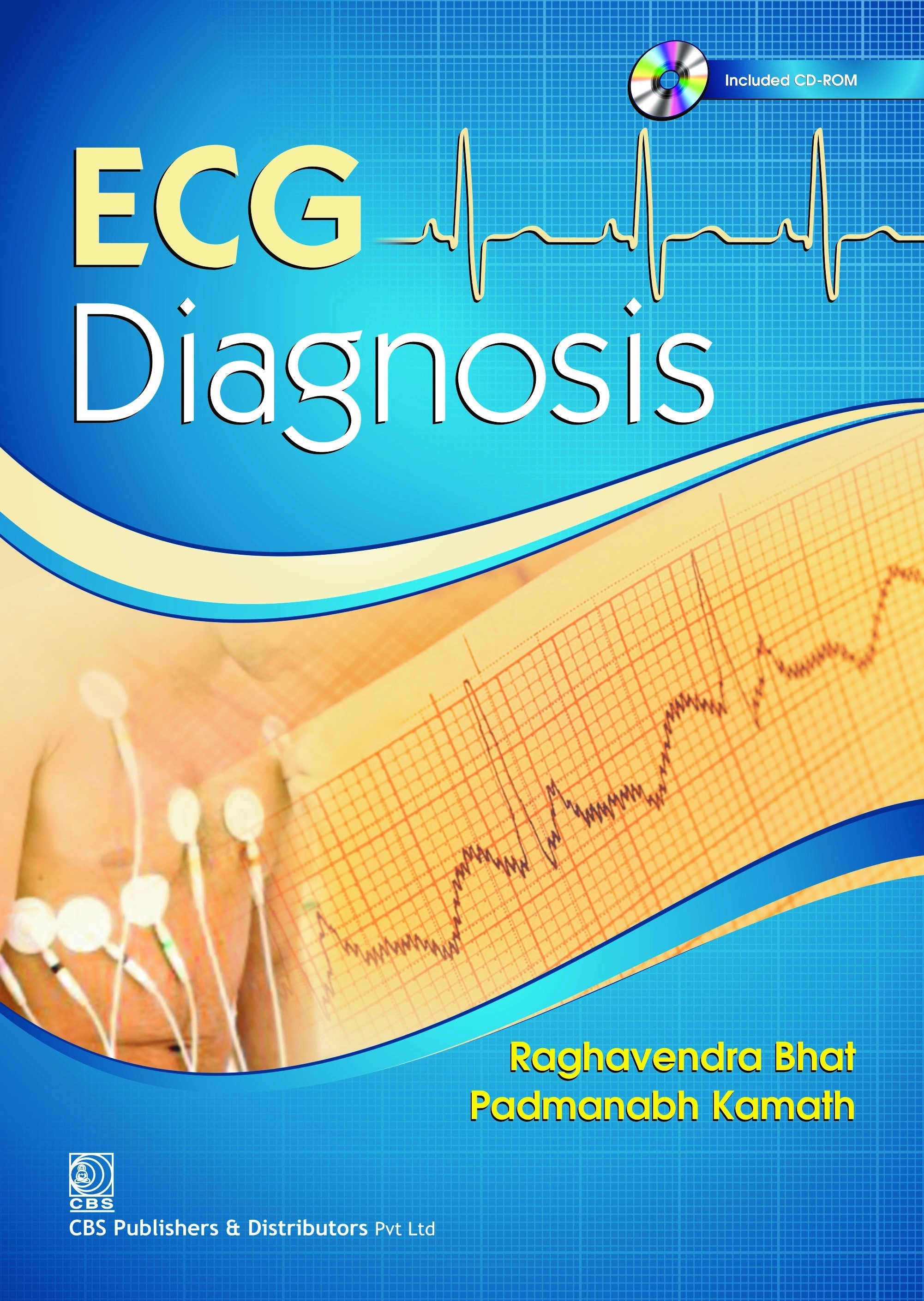 Ecg diagnosis