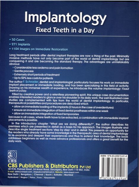 Implantology fixed teeth in a day