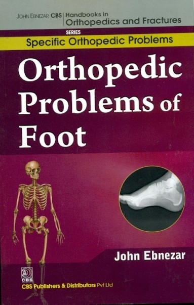 Orthopedic problems of foot (handbooks in orthopedics and fractures series, vol. 42: specific orthopedic problems )