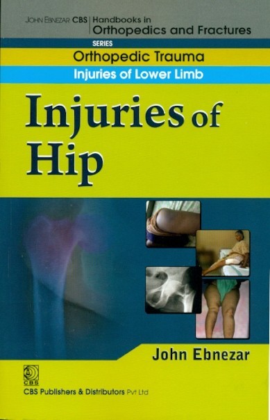 Injuries of hip (handbook of orthopedics and fratures series, vol. 13: orthopedic trauma injuries of lower limb)