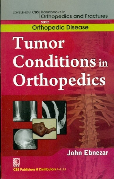 Tumor conditions in orthopedics (handbooks in orthopedics and fractures series, vol. 36: orthopedic disease)