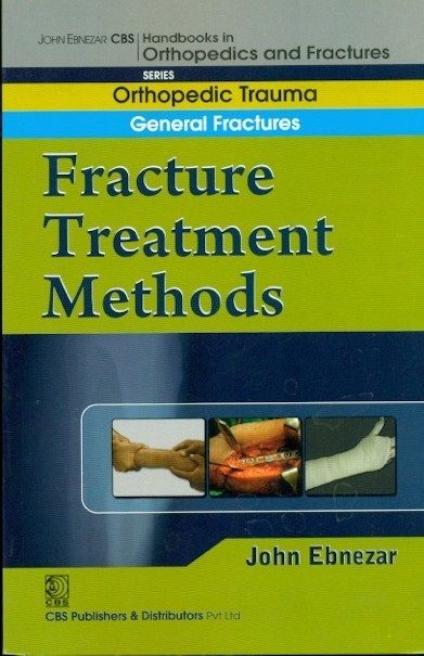 Fracture treatment methods (handbook in orthopedics and fractures vol.02 - orthopedic trauma general fractures)