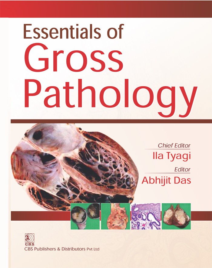 Essentials of gross pathology