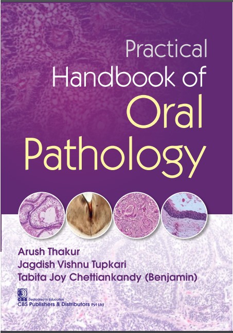 Practical handbook of oral pathology
