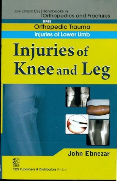 Injuries of knee and leg ( handbook in orthopedics and fractures series vol.16- orthopedic trauma injuries of lower limb)