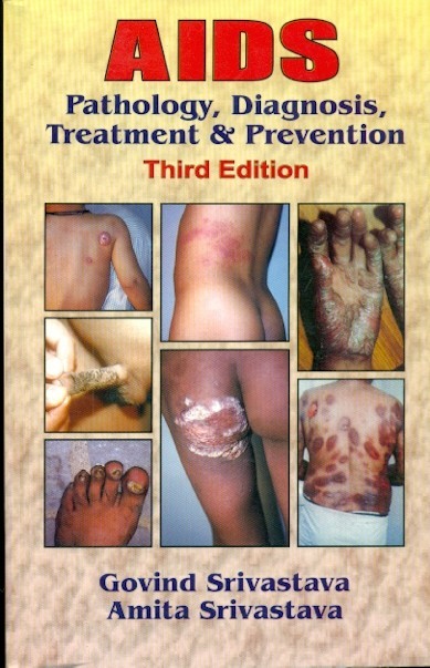 Aids pathology, diagnosis, treatment & prevention