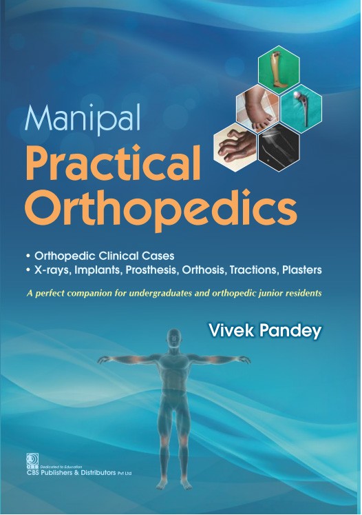 Manipal practical orthopedics: a perfect companion for undergraduates and orthopedic junior residents