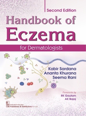 Handbook of eczema for dermatologists