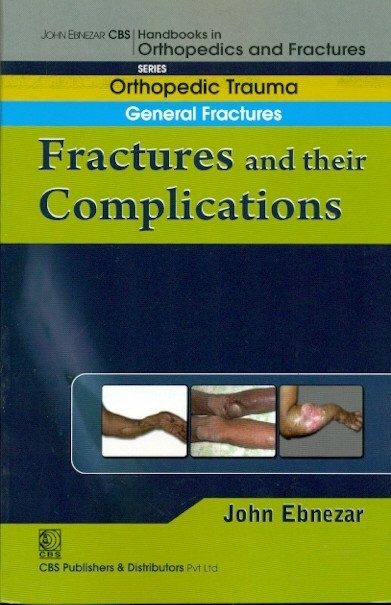 Fractures and their complications (handbook in orthopedics and fractures vol.3 - orthopedic trauma general fractures)