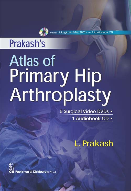 Prakash's: atlas of primary hip arthroplasty