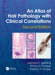 An atlas of hair pathology with clinical correlations 2ed (hb 2012) 