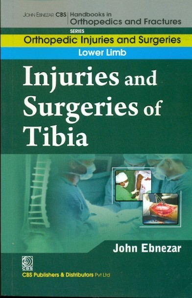 Injuries and surgeries of tibia (handbooks in orthopedics and fractures series, vol. 57: orthopedic injuries and surgeries lower limb)