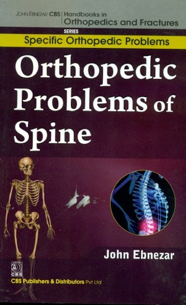 Orthopedic problems of spine (handbooks in orthopedics and fractures series, vol.38-specific orthopedic problems)
